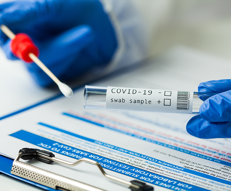 Νέα αναθεωρημένη τιμή για το Test Covid-19 με τη μοριακή μέθοδο (PCR) από 06/01/2022 