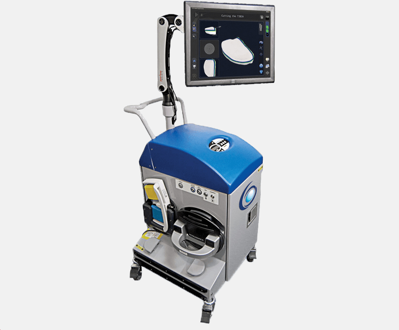 NAVIO: Robot-Assisted System for Knee Arthroplasty