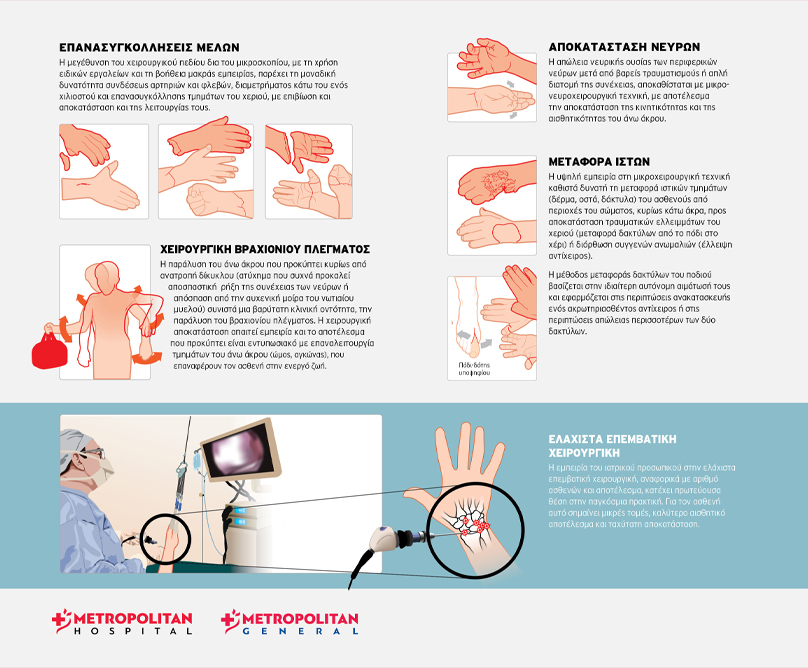 Metropolitan General: Οι πιο σύγχρονες θεραπείες για όλες τις παθήσεις των χεριών