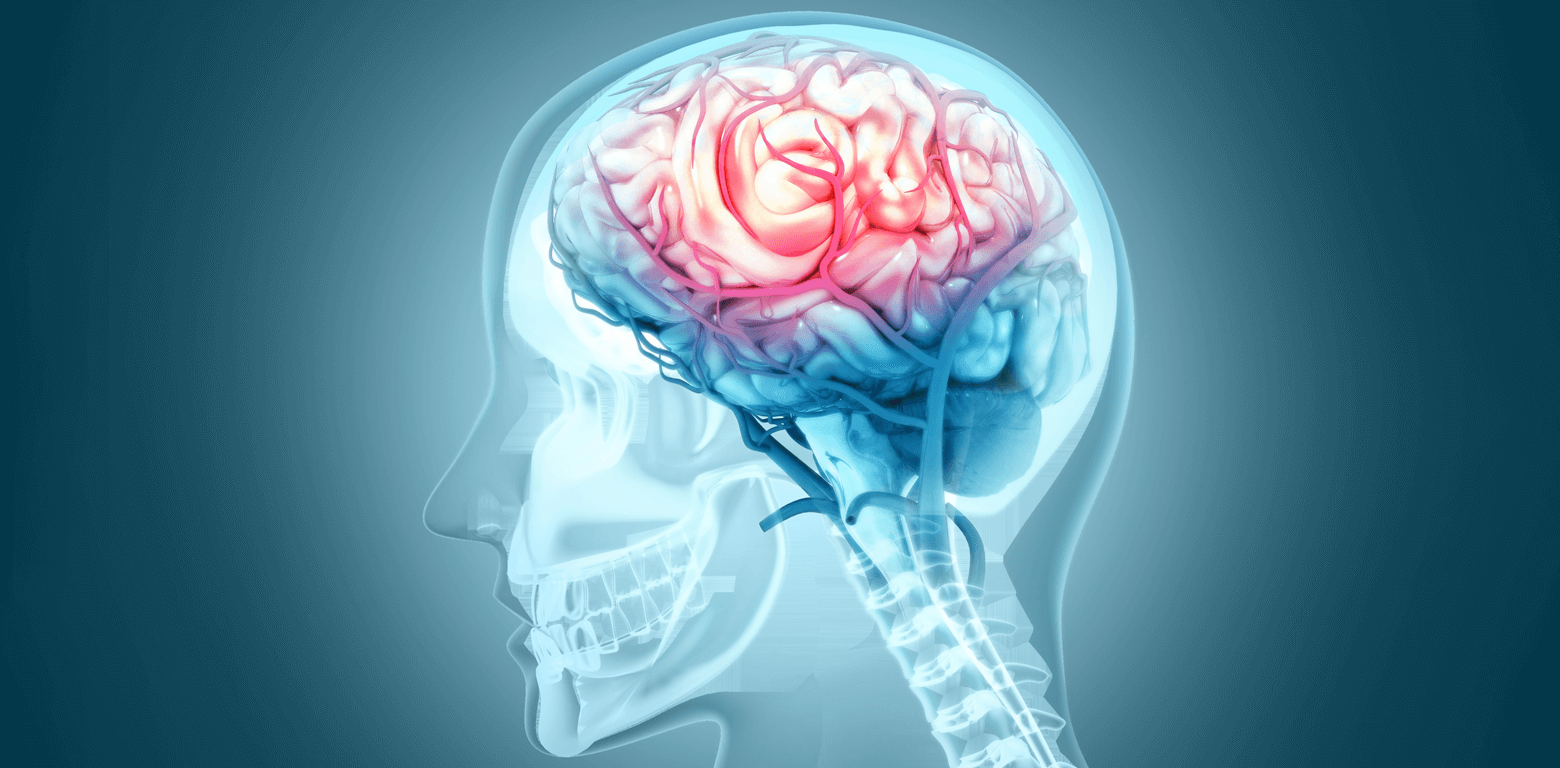 Τμήμα Αγγειακών Παθήσεων του Εγκεφάλου - Cerebrovascular Center