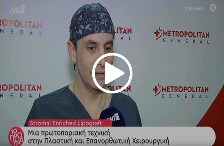 Τεχνική Stromal Enriched Lipograph - Άρης Στεροδήμας