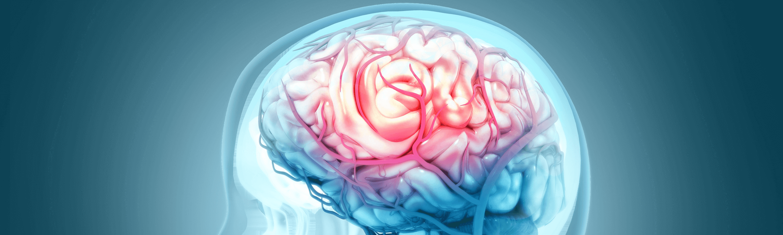 Τμήμα Αγγειακών Παθήσεων του Εγκεφάλου - Cerebrovascular Center