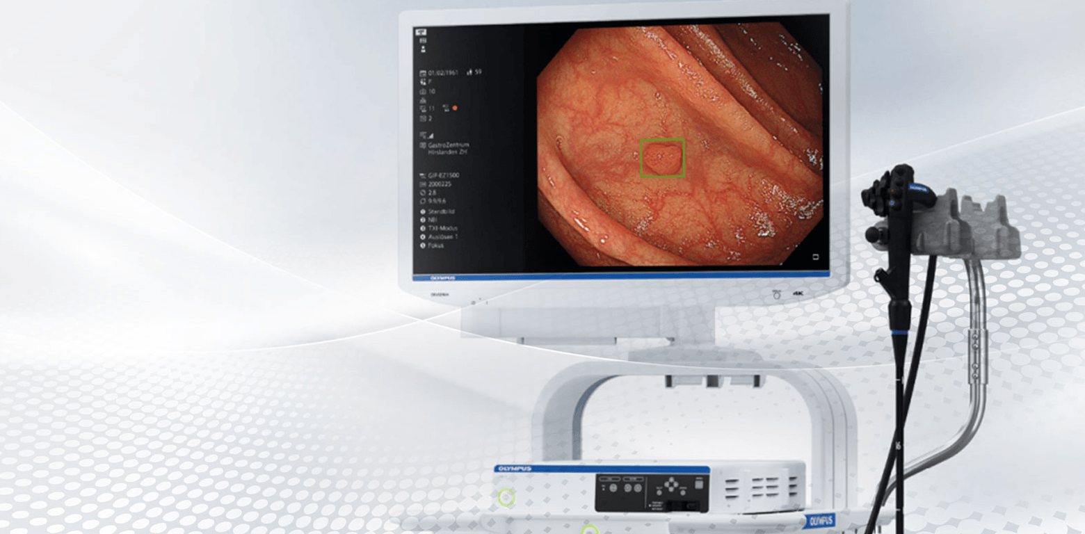 Image-Enhanced Video Endoscopy Systems for the ESD Technique