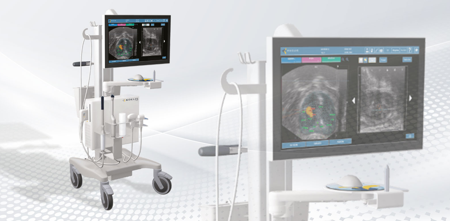 Fusion Biopsee for Prostate Cancer Diagnosis
