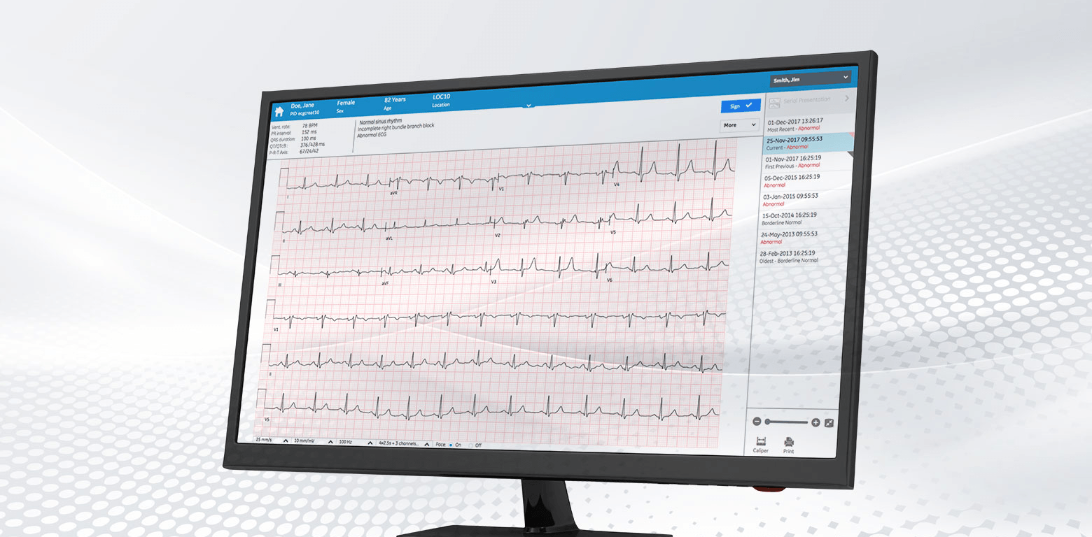 MUSE System: Management of electrocardiograms and vital signs