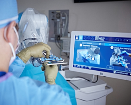 Εικόνα χειρουργού να χρησιμοποιεί το ρομποτικό σύστημα ROSA