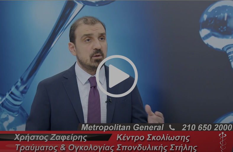 Οστεοπόρωση & σπονδυλική στήλη | Χρήστος Ζαφείρης
