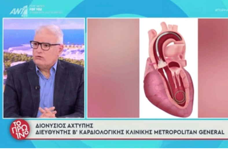 Διονύσιος Αχτύπης | Στένωση Αορτικής Βαλβίδας: Αντικατάσταση χωρίς ανοιχτό χειρουργείο (TAVI)