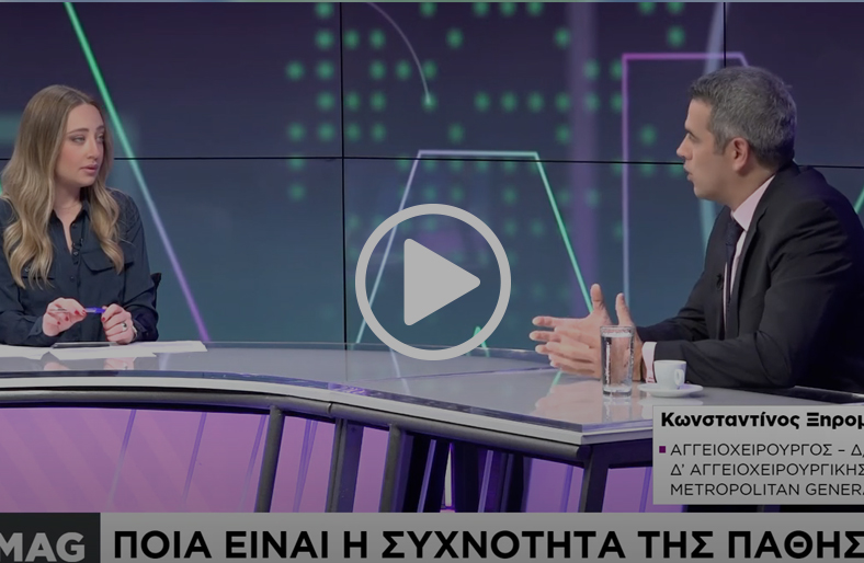 Φλεβική ανεπάρκεια & κιρσοί | Κωνσταντίνος Ξηρομερίτης