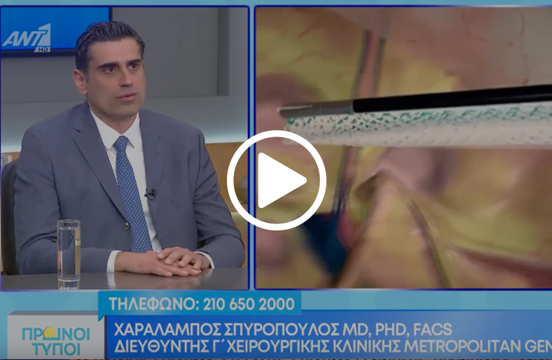 Κήλες κοιλιακού τοιχώματος│Χαράλαμπος Σπυρόπουλος