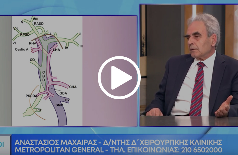 Λαπαροσκοπική χολοκυστεκτομή│Αναστάσιος Μαχαίρας