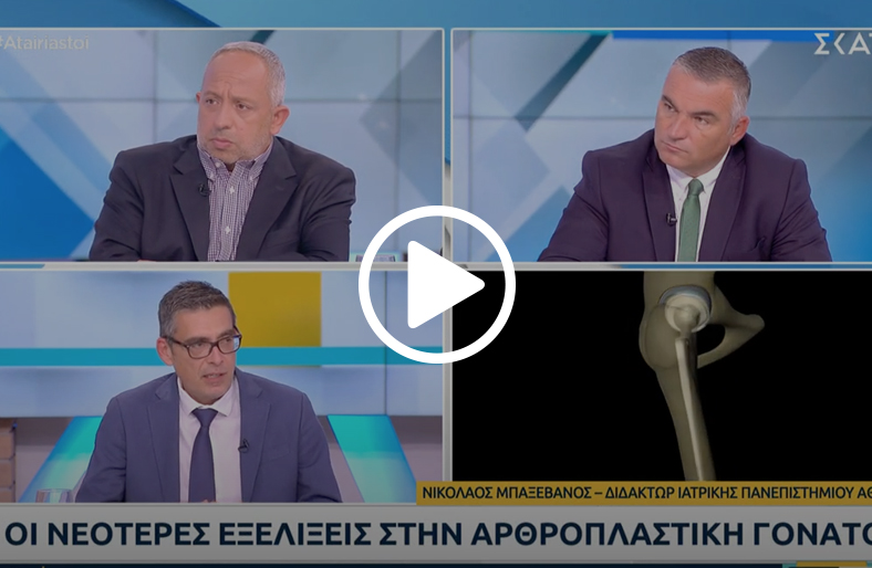 Ολική Αρθροπλαστική Γόνατος | Νικόλαος Μπαξεβάνος